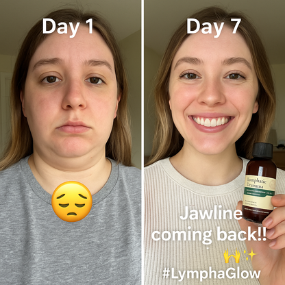 LymphaVita™ – Rapid Herbal Drainage Drops