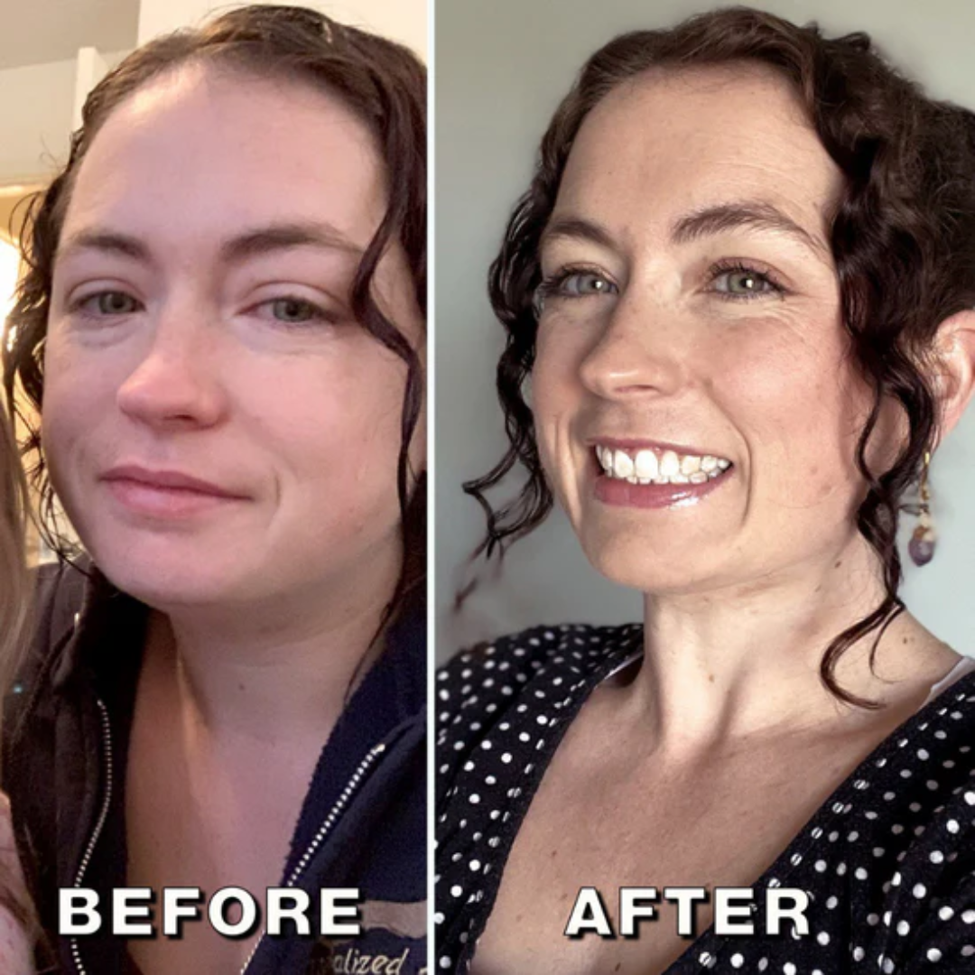 LymphaVita™ – Rapid Herbal Drainage Drops