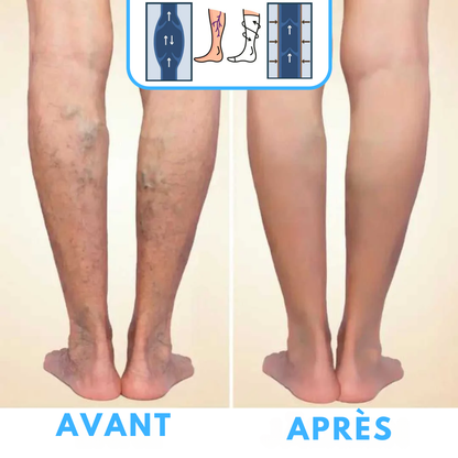 ZenChaussettes™ | Chaussettes de compression